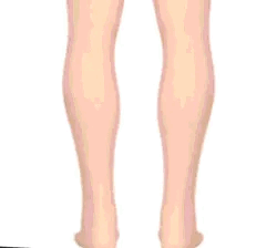 Sandales orthopédiques avec soutien de la voûte plantaire pour femme